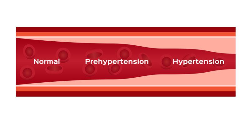 How can high blood pressure affect oral surgery? 