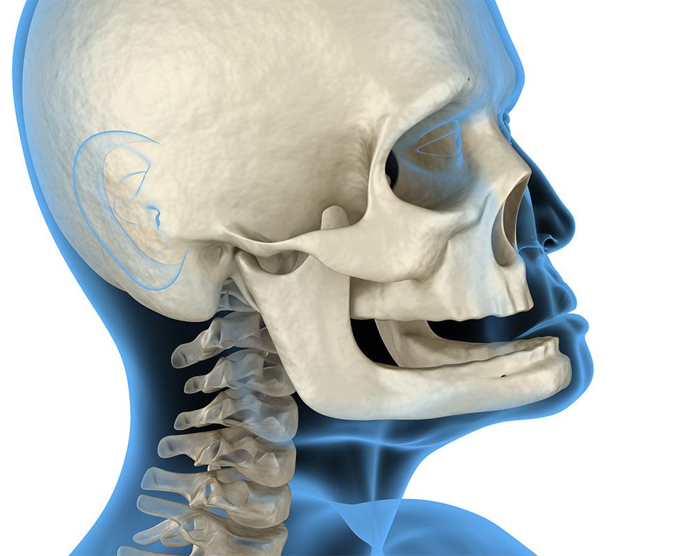 skeletal image of human male for corrective jaw surgery