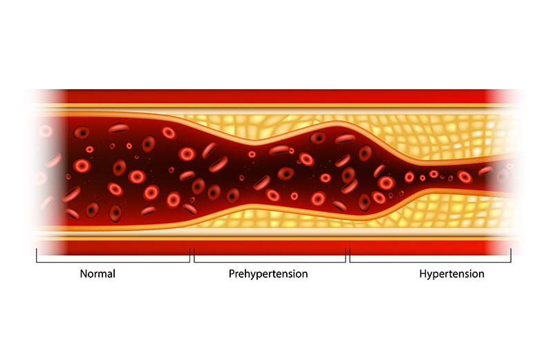 how do heart problems affect oral surgery