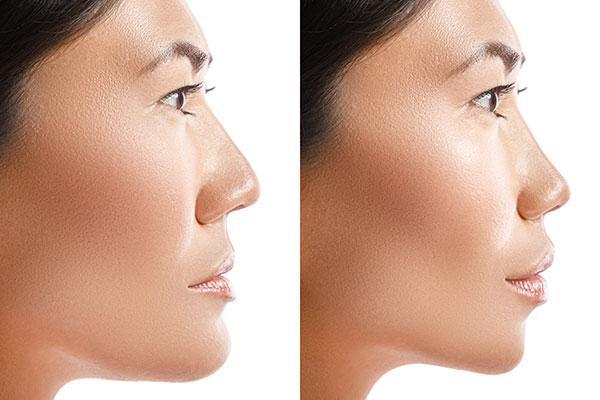 corrective jaw surgery in Phoenix, Arizona